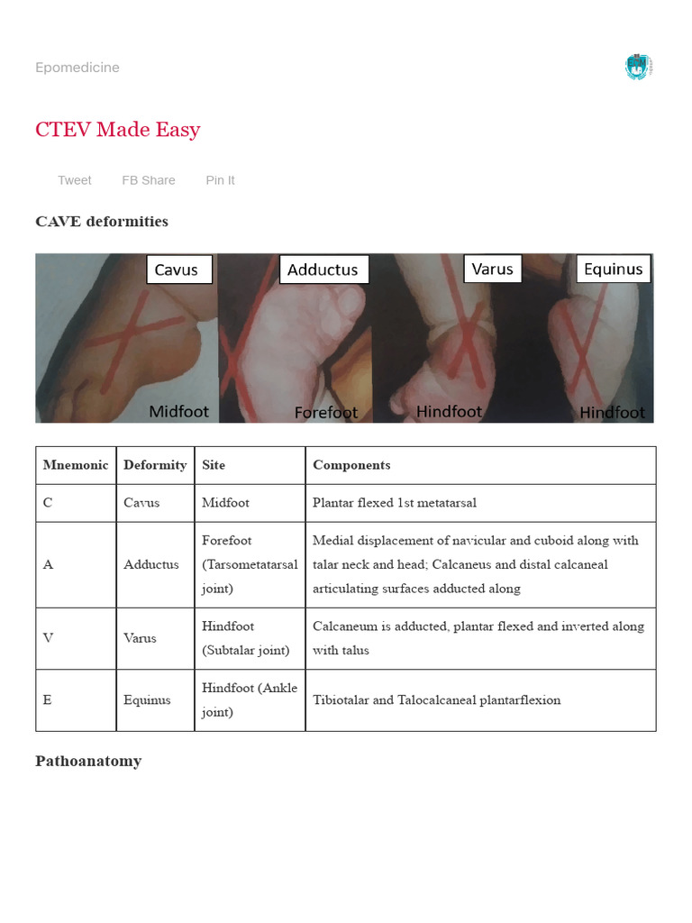 Understanding CTEV: Diagnosis and Treatment | PDF | Foot | Ankle