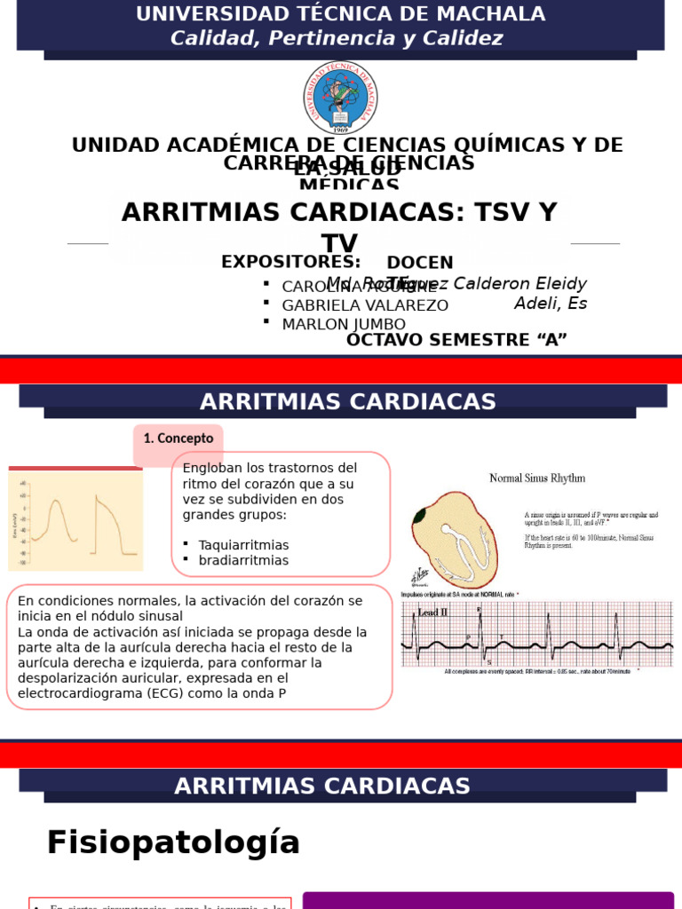 Arritmias Cardiacas | PDF | Enfermedades y trastornos | Arritmia cardiaca
