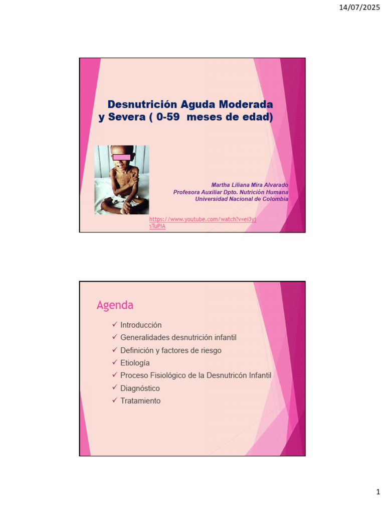 Desnutrición Aguda Moderada en Infantes | PDF | Desnutrición ...