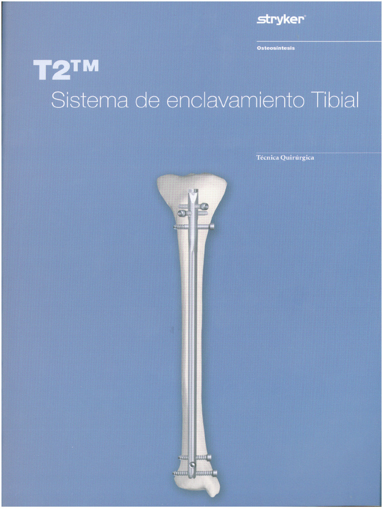 T2 Tibia | PDF