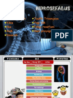 Hidrocepalus