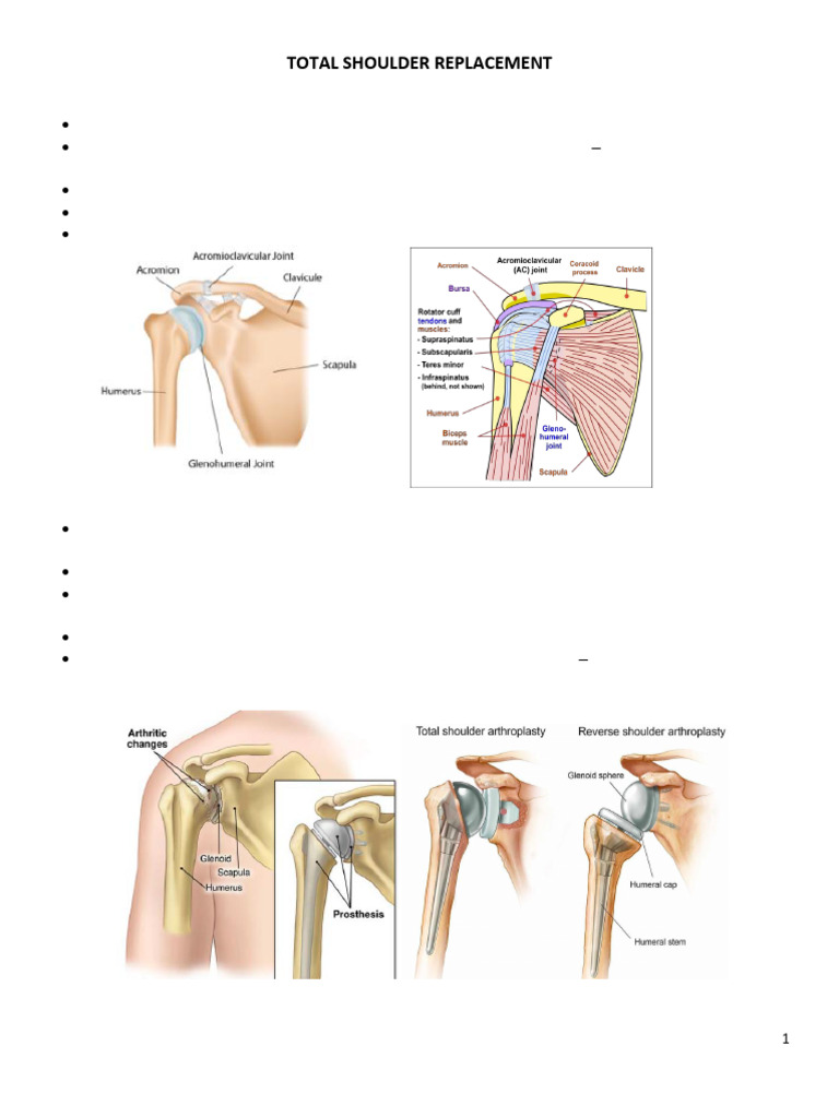 Total Shoulder Replacement Pre Op Packet | PDF | Anatomical Terms Of ...