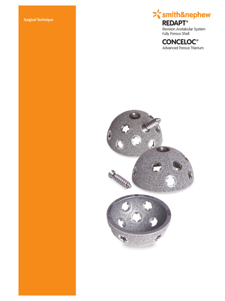 V5 71381752 REVD REDAPT Revision Acetabular Shell Surgical Technique ...