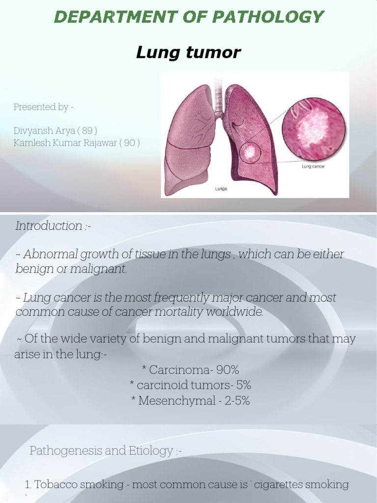 Overview of Lung Tumors and Prevention | PDF | Lung Cancer | Carcinoma