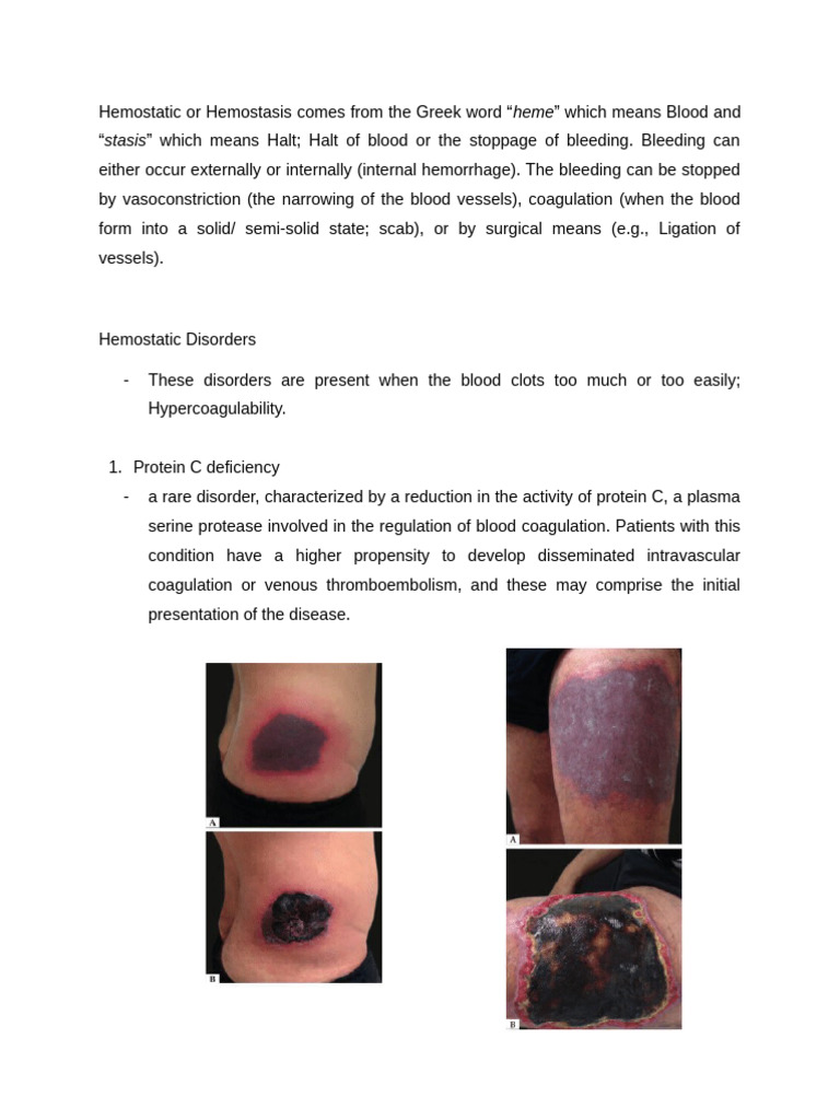 Understanding Hemostatic Disorders | PDF | Coagulation | Bleeding