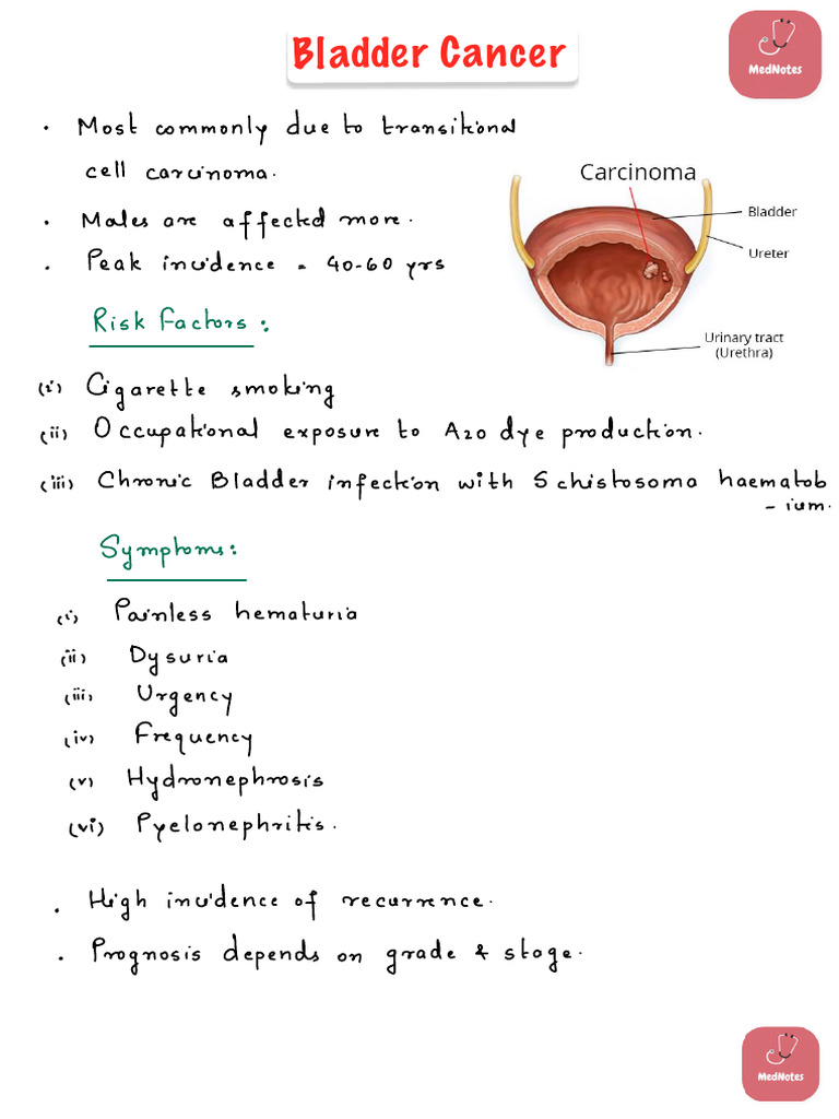 Bladder Cancer Overview and Management | PDF