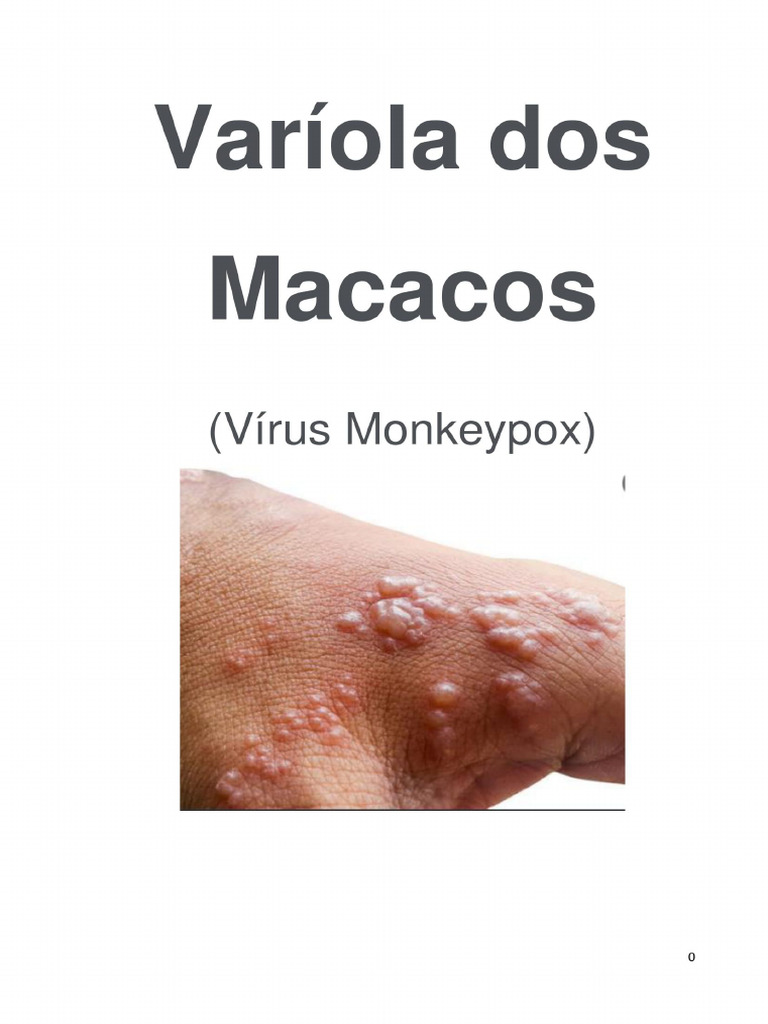 Cartilha Variola | PDF