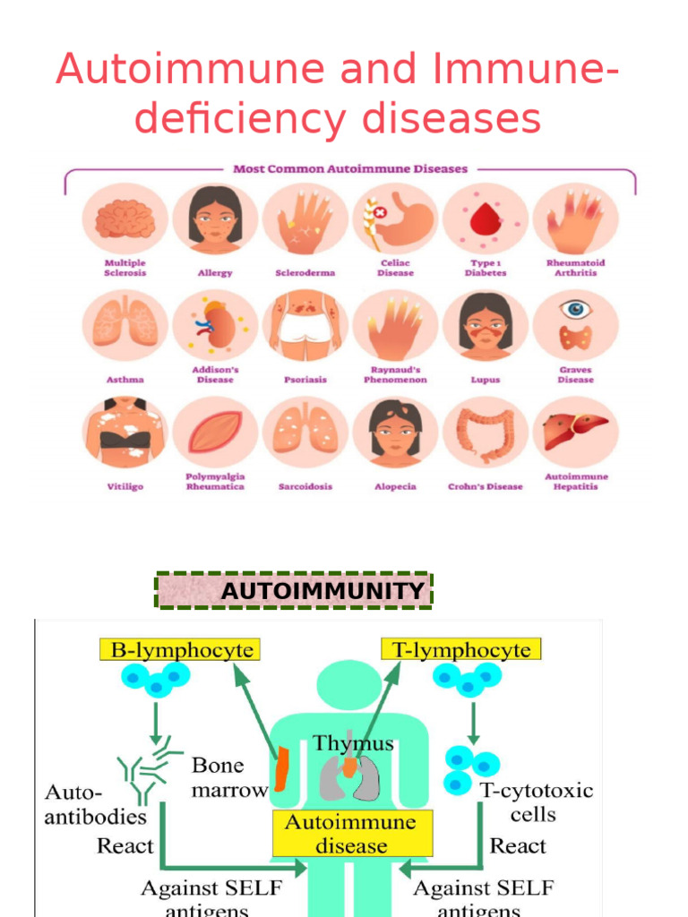 Overview of Autoimmune Thyroid Disease | PDF | Immune Tolerance ...