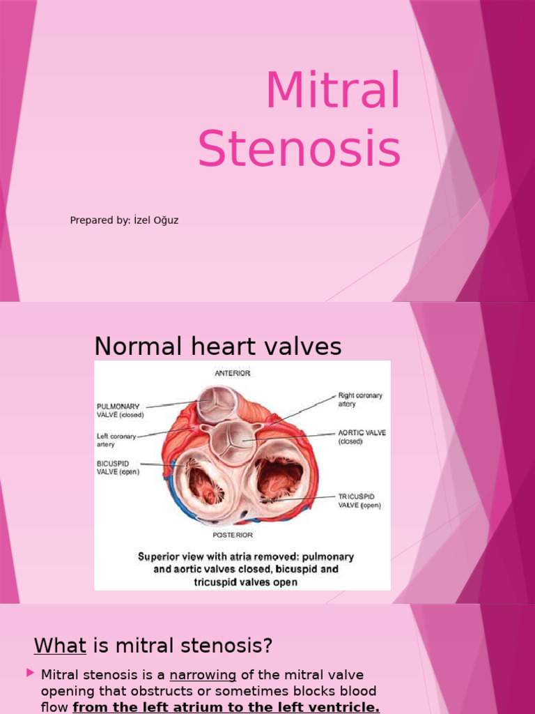 Understanding Mitral Stenosis | PDF | Cardiovascular System | Diseases ...