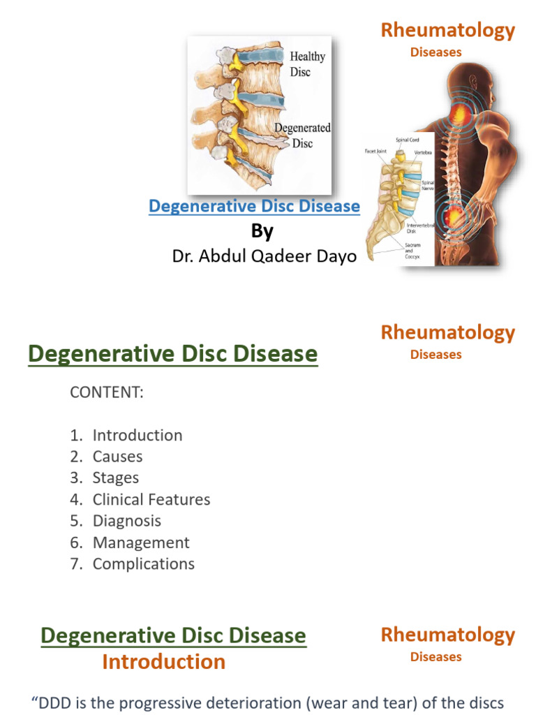 Lecture 16 - Disc Diseases | PDF | Human Anatomy | Musculoskeletal System