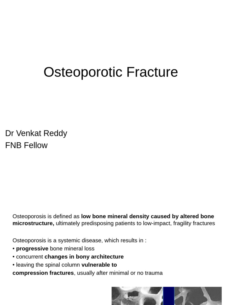 Osteoporotic Fractures: Risks and Management | PDF | Osteoporosis | Bone