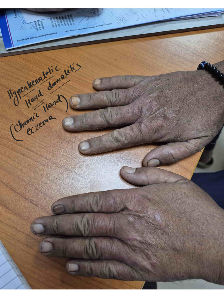Derma Cases | PDF