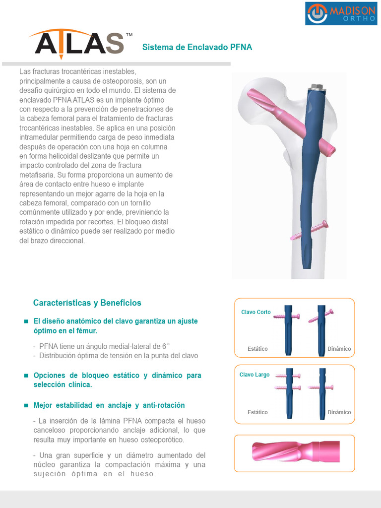 Sistema de Enclavado PFNA: Beneficios y Usos | PDF | Hueso