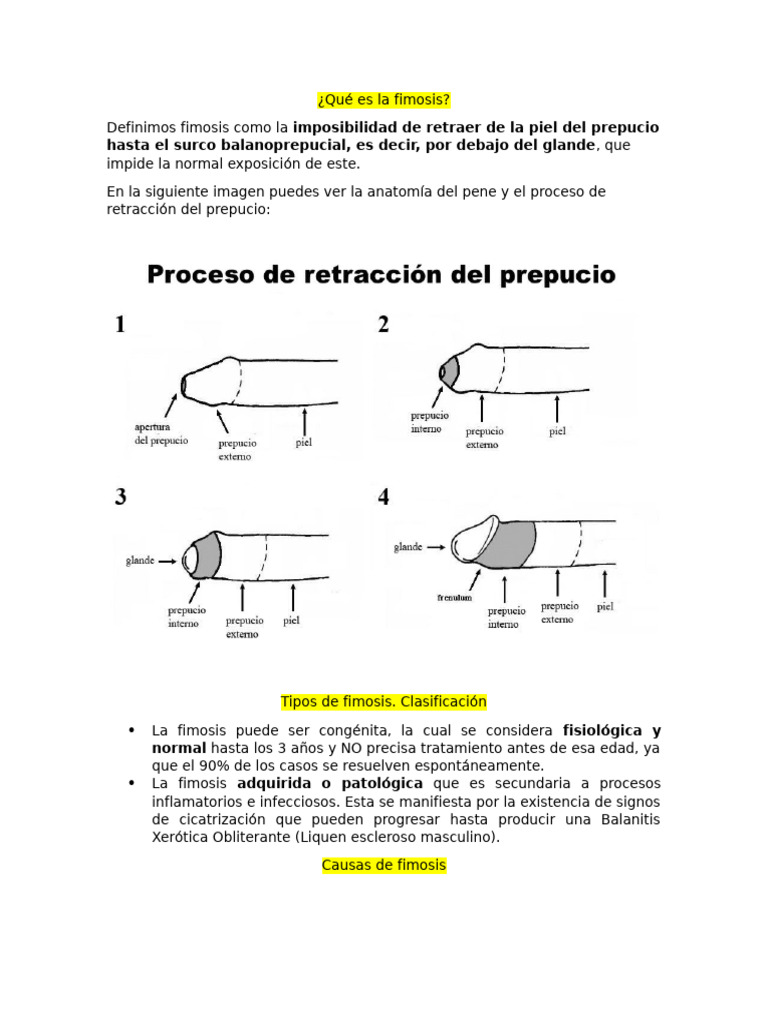 Grados de fimosis y su clasificación | PDF | Circuncisión | Pene