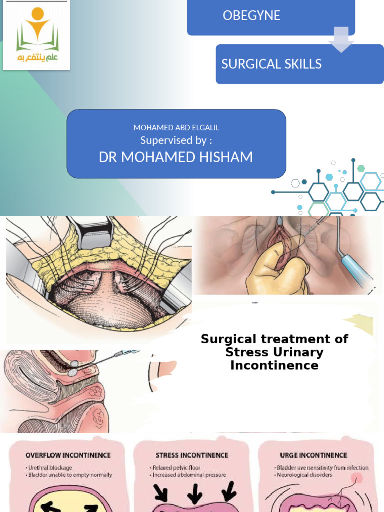 Surgical Treatment for Stress Incontinence | PDF | Urinary Incontinence ...