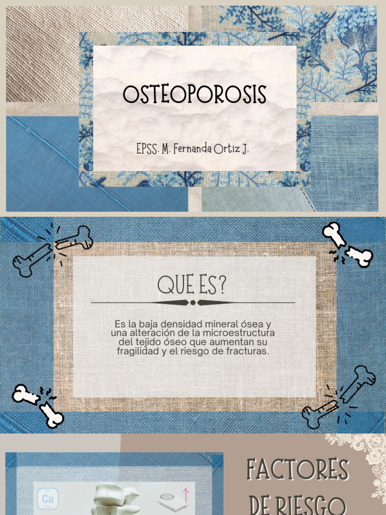 Guía Completa sobre Osteoporosis | PDF