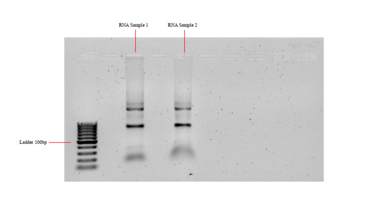 RNA Sample 1 RNA Sample 2 | PDF