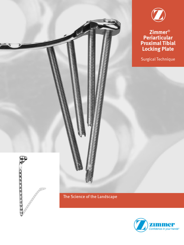 Zimmer Proximal Tibial Locking Plate Guide | PDF | Screw