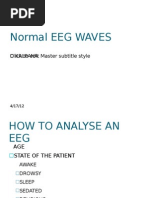 Normal Eeg Waves