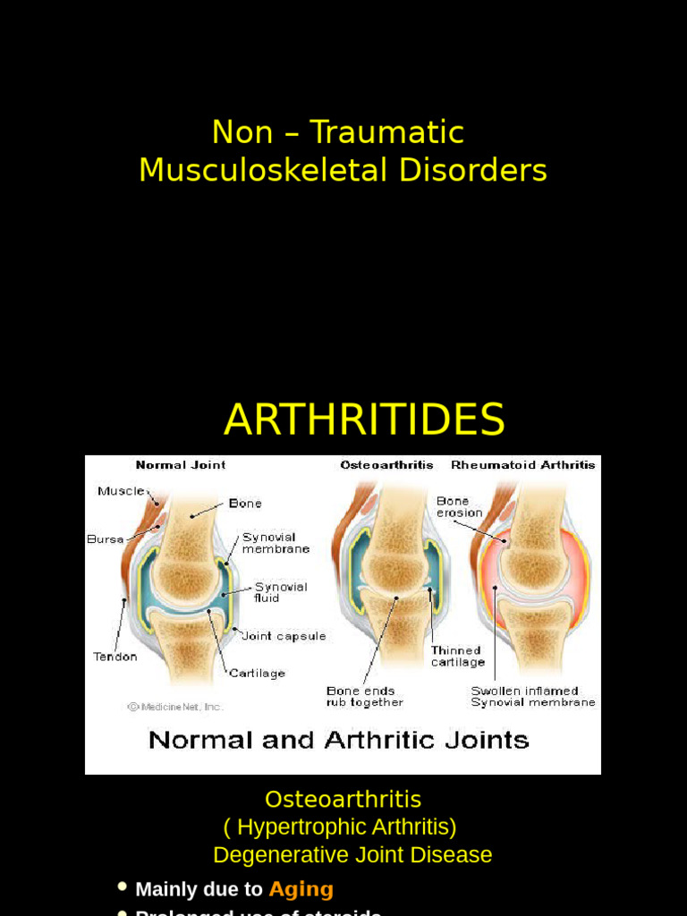Understanding Non-Traumatic Arthritides | PDF | Gout | Osteoarthritis
