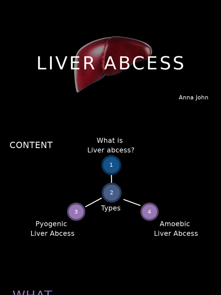Liver Abscess: Types and Management | PDF