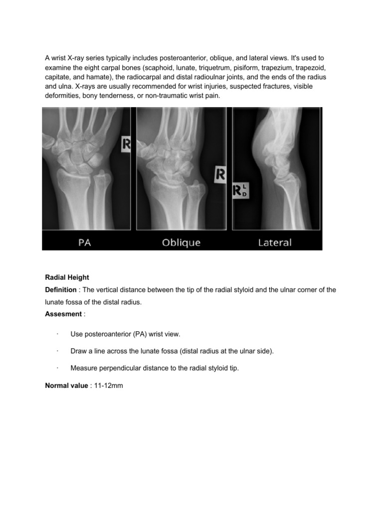Wrist X-Ray Assessment Techniques | PDF