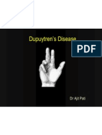 Dupuytrens Disease