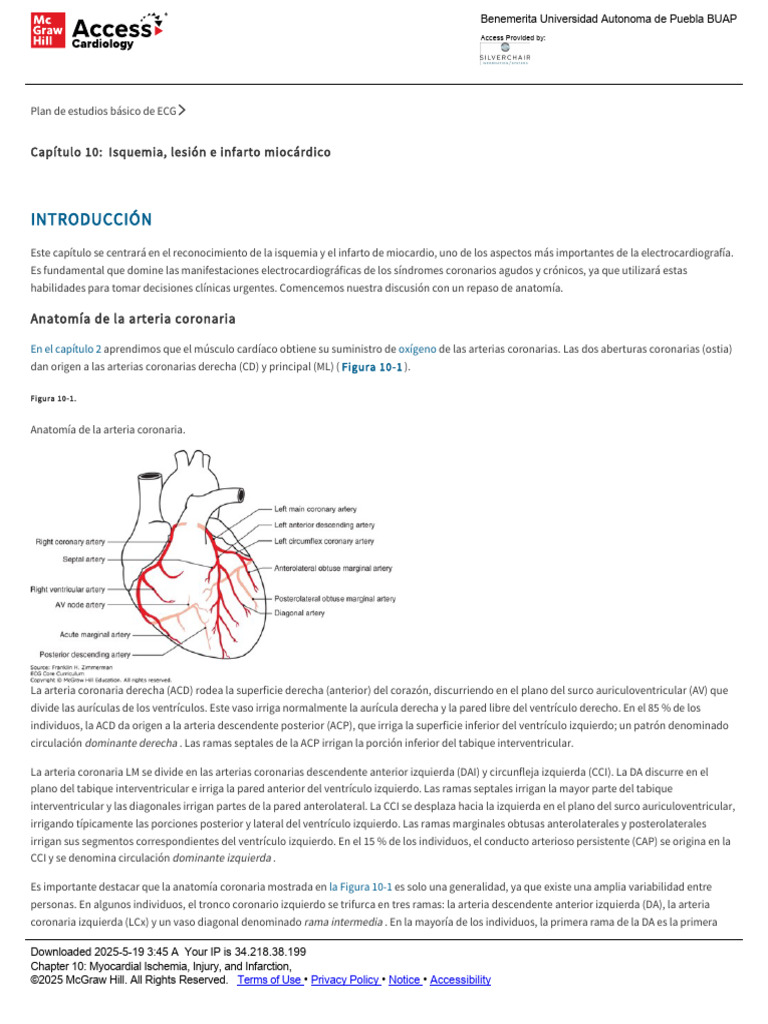 Isquemia e Infarto Miocárdico en ECG | PDF | Infarto de miocardio | Corazón