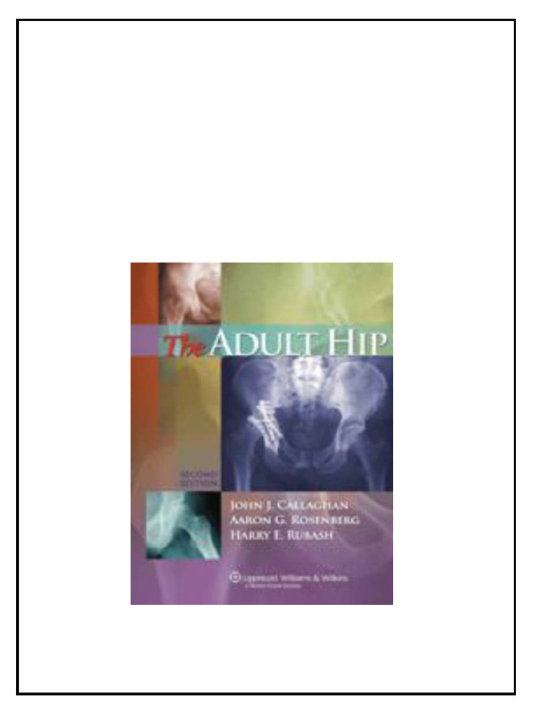 The Adult Hip 2nd Edition Second Callaghan John J Rosenberg Download | PDF