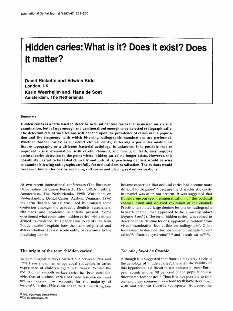 Understanding Hidden Caries in Dentistry | PDF | Tooth Enamel | Mouth