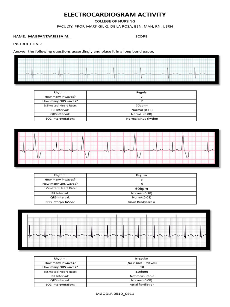 ECG Interpretations and Analysis | PDF | Electrocardiography | Heart Rate