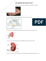 15 Enfermedades Del Sistema Urinario