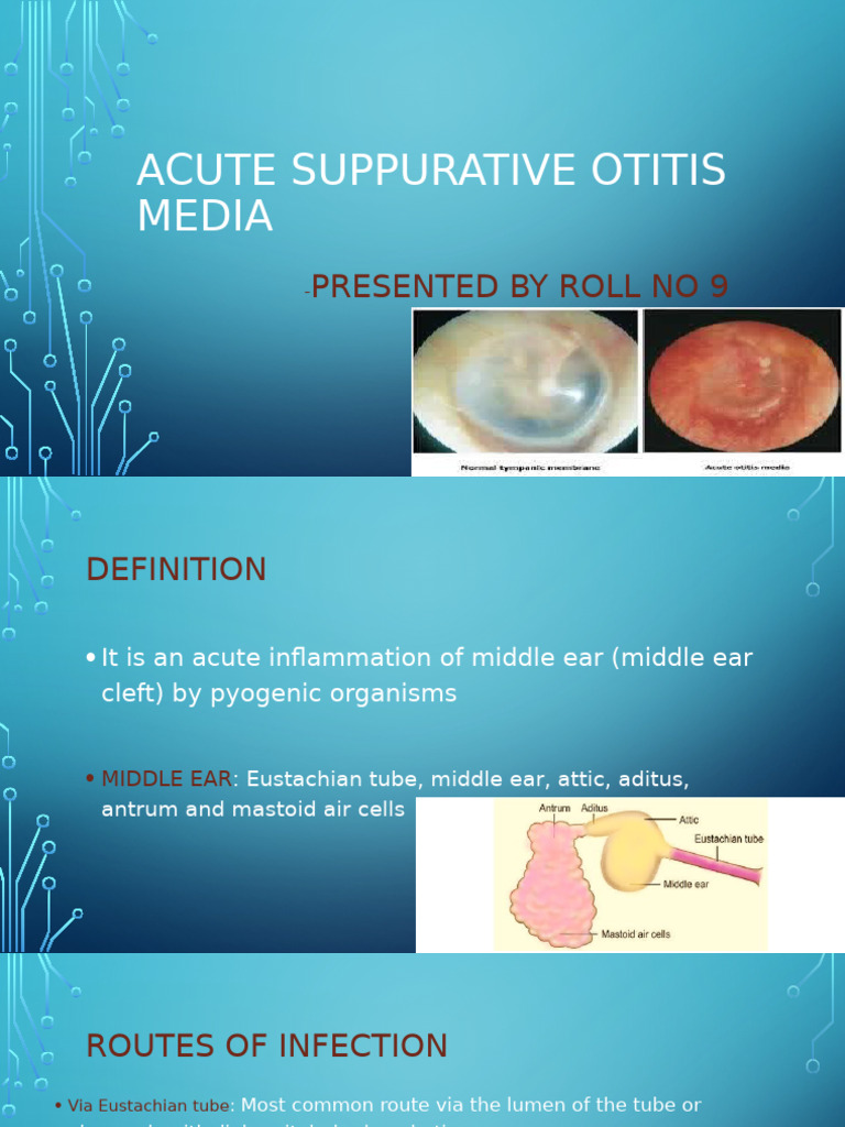 Acute Suppurative Otitis Media Overview | PDF | Surgical Specialties ...