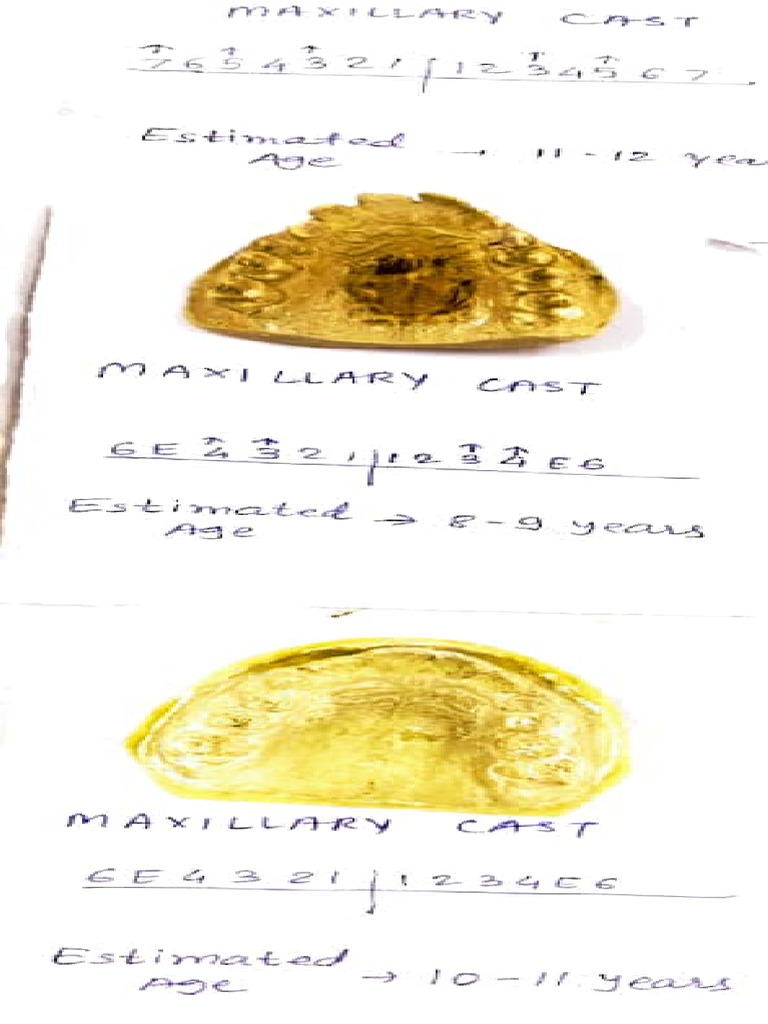 Maxillary and Mandibular Cast Ages | PDF
