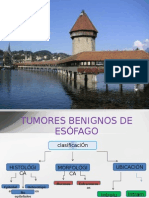 Tumores Benignos de Esófago