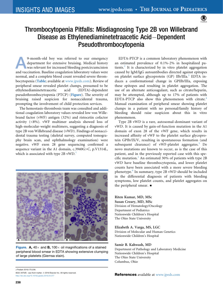 Misdiagnosing Type 2B von Willebrand Disease | PDF | Platelet | Coagulation