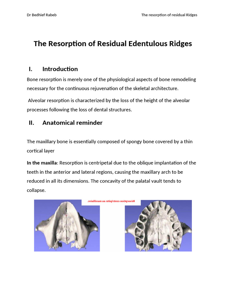 5.the Resorption of Residual Edentulous Ridges | PDF | Bone | Dentistry ...