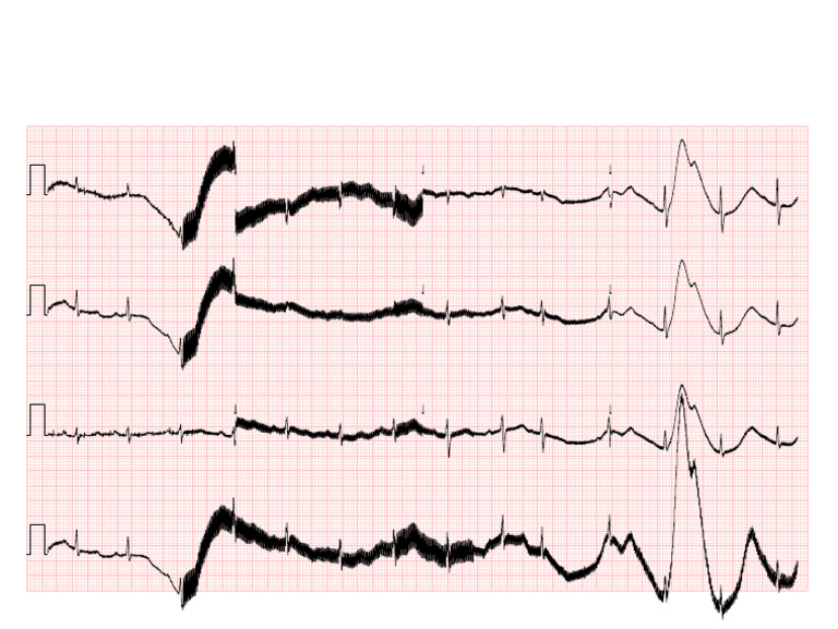 R Ecg 0 20200901091043 20210206170405 | PDF