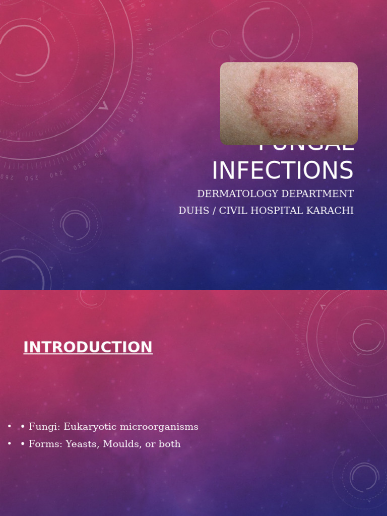 Overview of Fungal Infections | PDF | Medical Specialties | Mycology