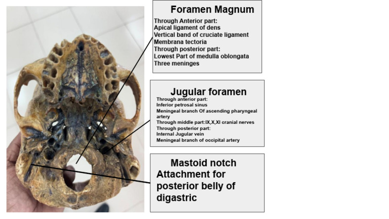 Anatomy of the Foramen Magnum | PDF