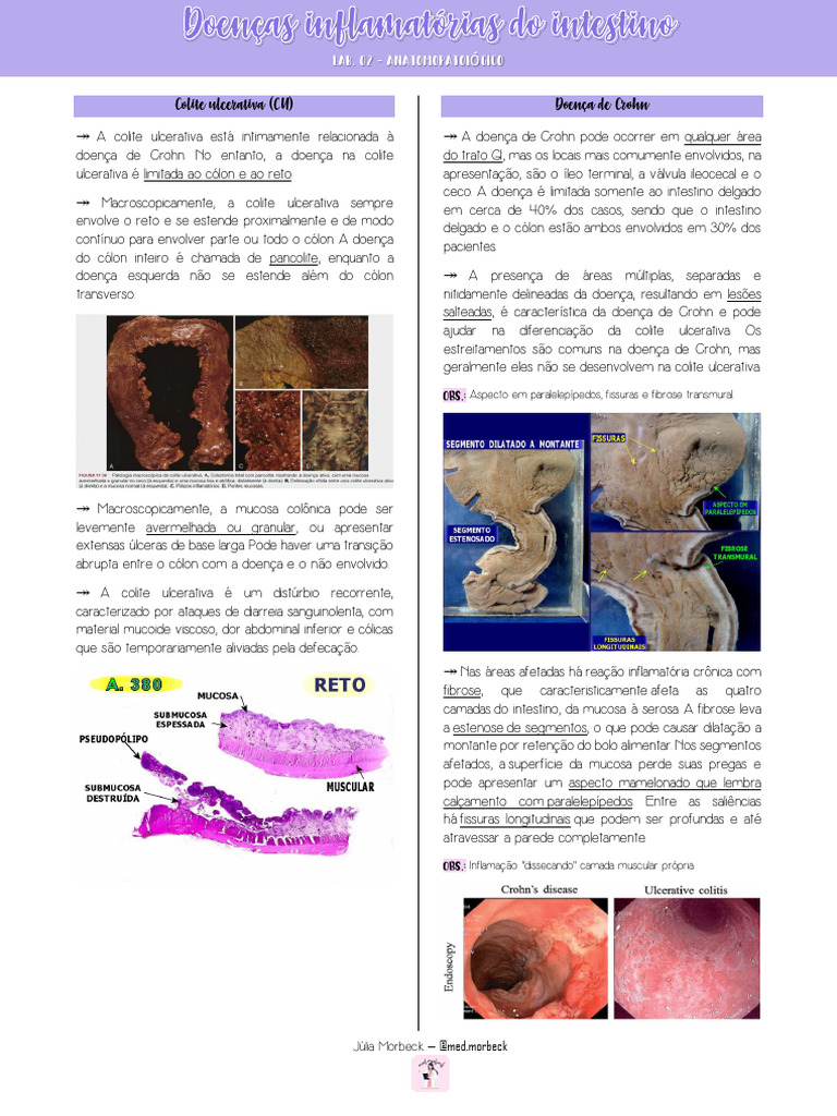 Diferenças entre Colite Ulcerativa e Crohn | PDF | Doença de Crohn ...