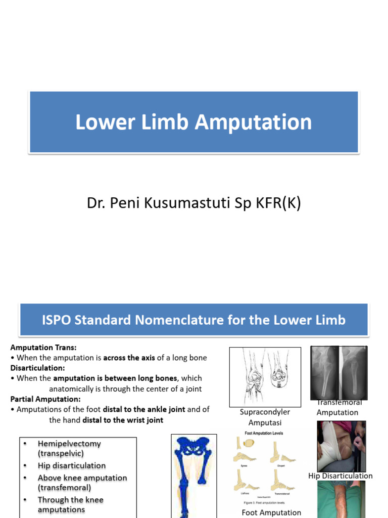 Lower Limb Amputation: Types & Management | PDF | Prosthesis | Amputation