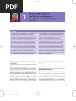 Download ECG Morphology by Mr Joko SN9004378 doc pdf