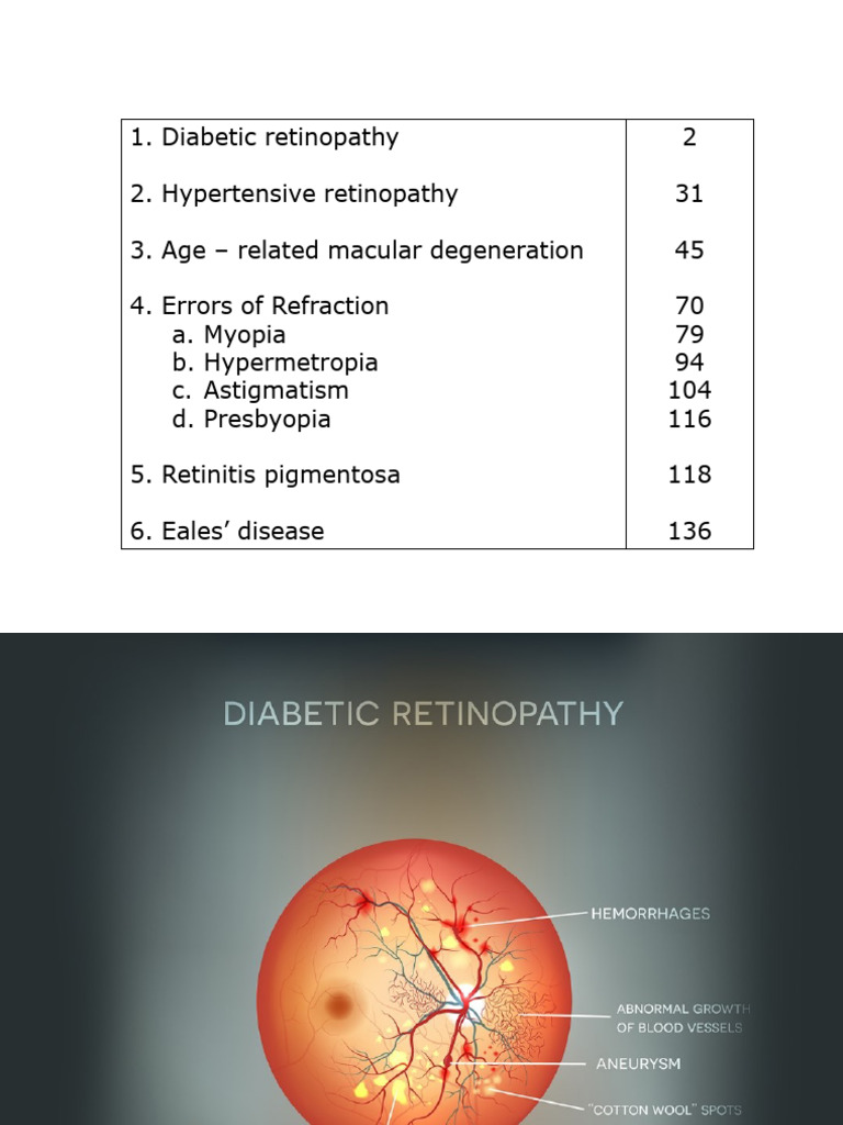 Eye Disorders: Diabetic & Hypertensive Retinopathy | PDF | Myopia | Retina