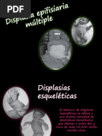 Displasia Epifisaria Multiple