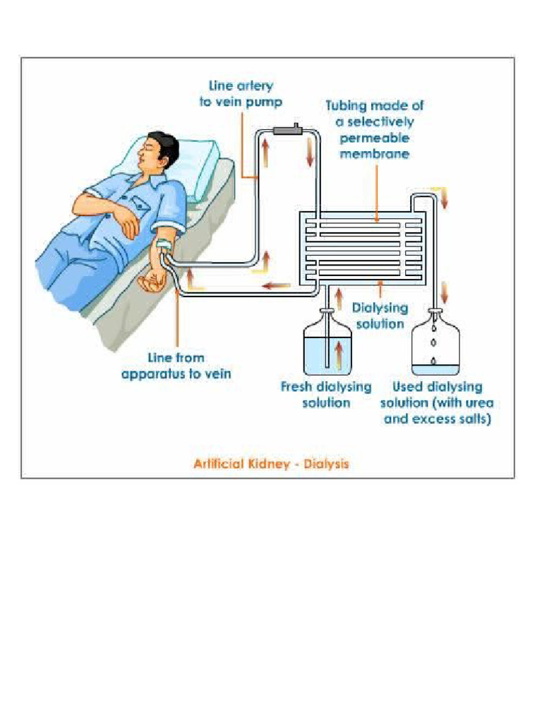 Dialysis | PDF