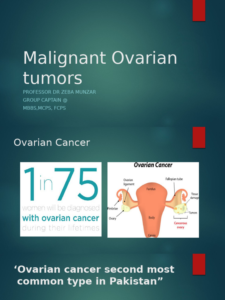 21-Malignant Ovarian Tumors FMC (Autosaved) Final | PDF | Ovarian ...