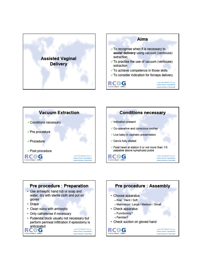 Vacuum Extraction Delivery Guide | PDF | Childbirth | Obstetrics