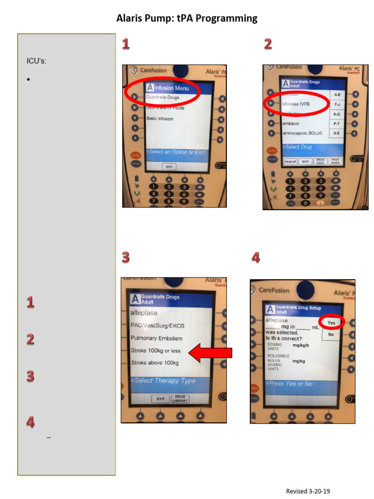 tPA Programming for Alaris Pump Guide | PDF