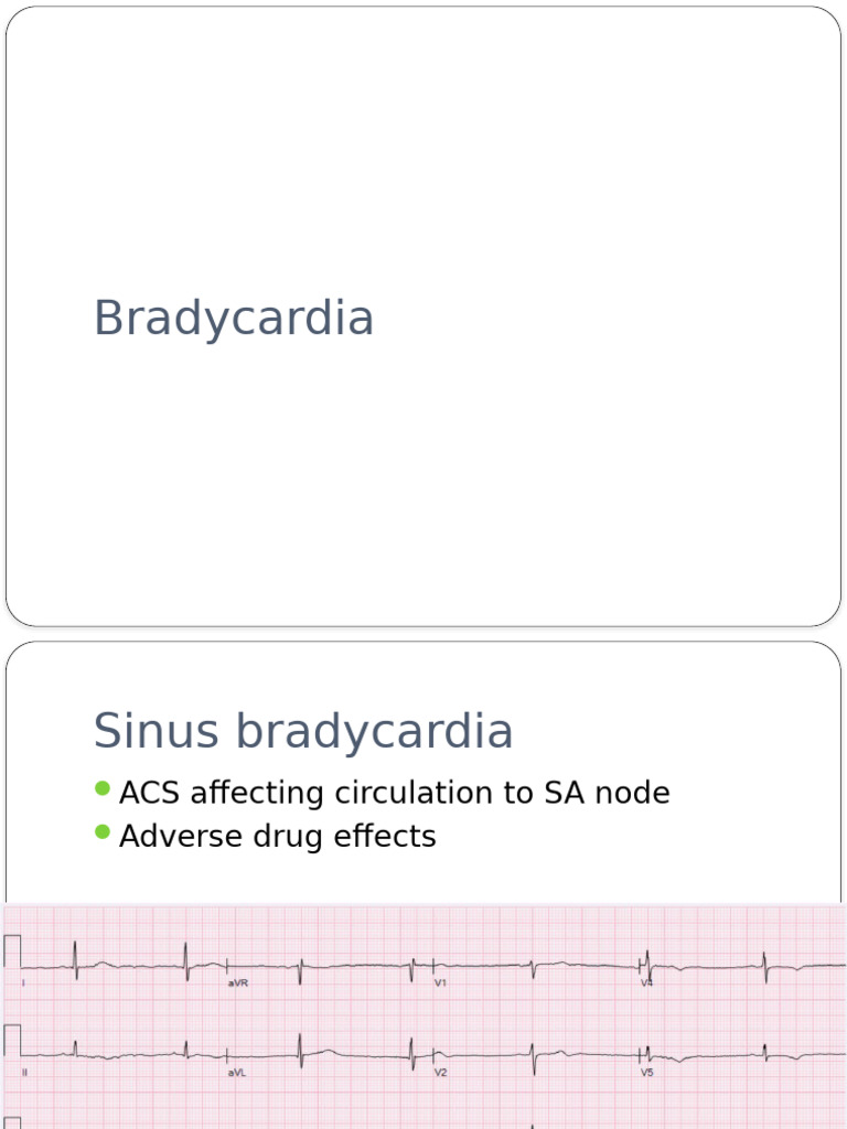ECG Patterns in Bradycardia | PDF
